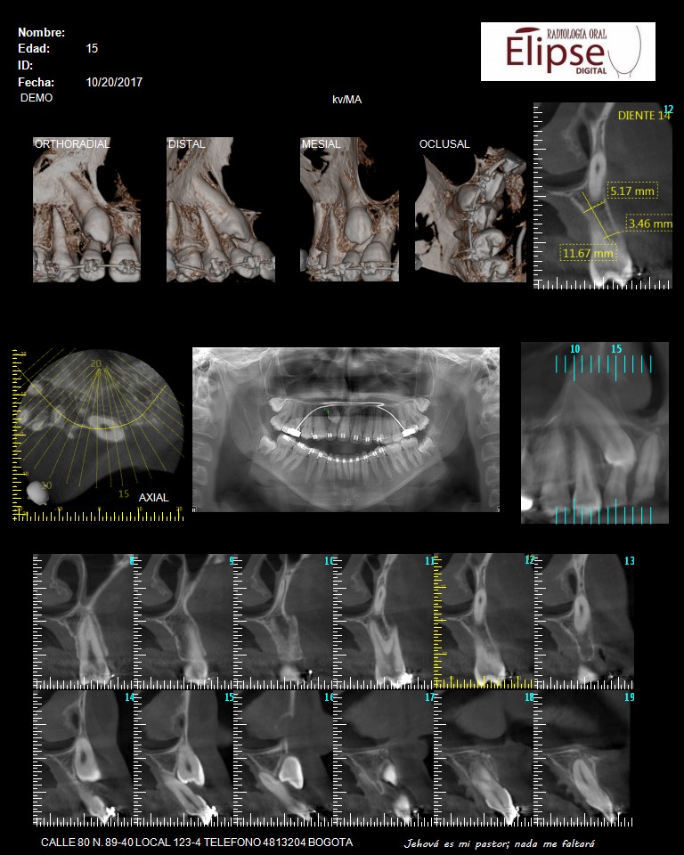Tomografia Dental